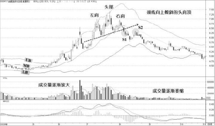 2.5 头肩顶：顶部结构失败常比成功更值得警惕（图 3）